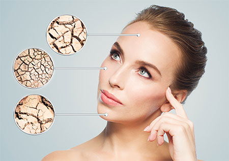 caractéristiques peau sèche